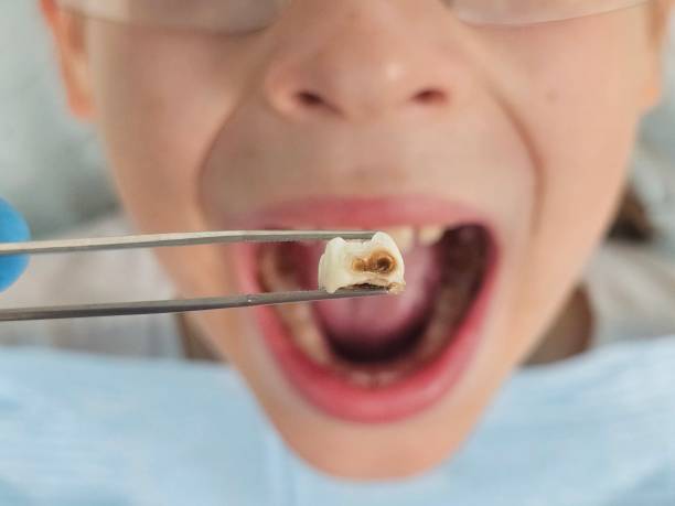 Best Emergency Cosmetic Dentistry (e.g., broken veneers) in Utqiagvik, AK